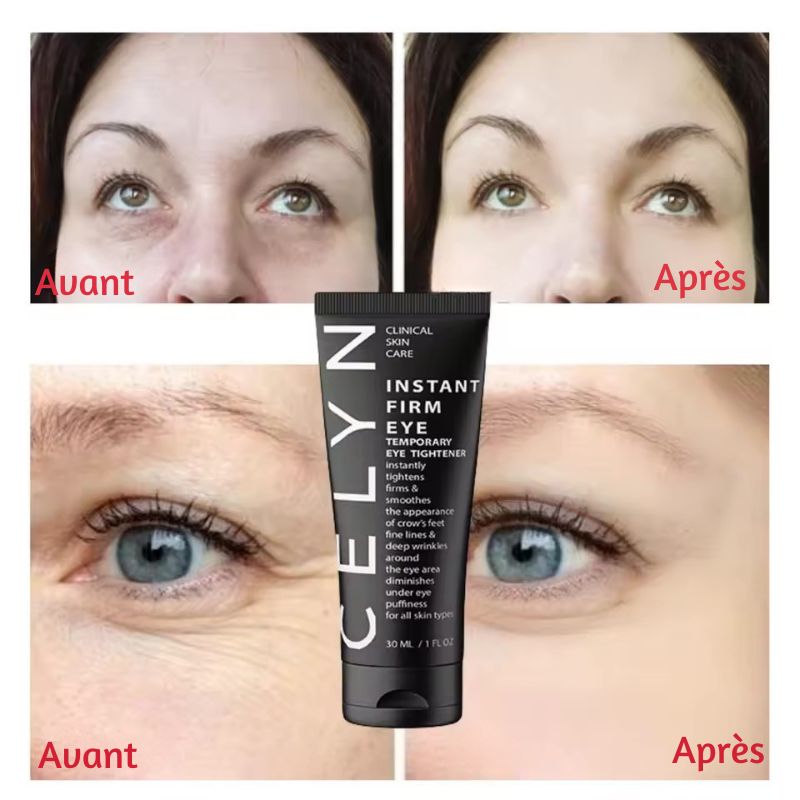 ✨ Crème Anti-Cernes & Rides Instantanée – Regard Jeune en 90 Secondes ✨