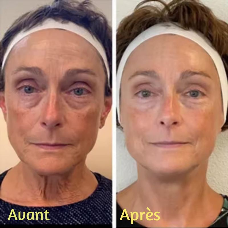 ✨ Crème Anti-Cernes & Rides Instantanée – Regard Jeune en 90 Secondes ✨