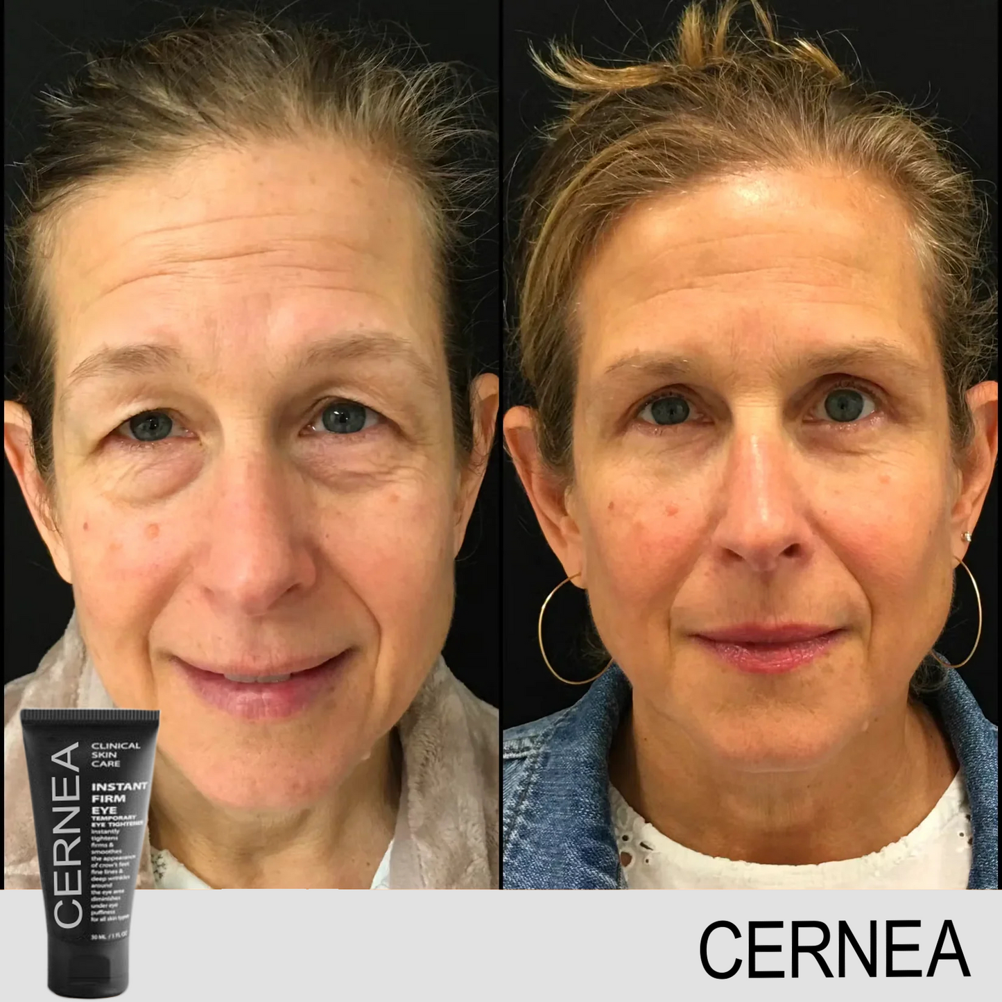 ✨ Crème Anti-Cernes & Rides Instantanée – Regard Jeune en 90 Secondes ✨