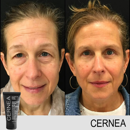 ✨ Crème Anti-Cernes & Rides Instantanée – Regard Jeune en 90 Secondes ✨